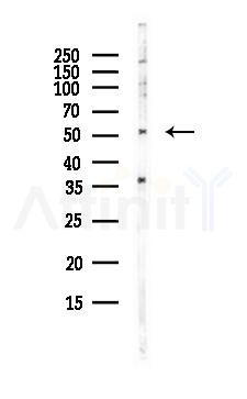 Tryptophan Hydroxylase Antibody - Western blot analysis of lysates from PC12 cells(LPS, 4h treatment), using Tryptophan Hydroxylase Antibody at 1/1000 dilution.