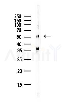 Tryptophan Hydroxylase Antibody - Western blot analysis of lysates from Rat lung, using Tryptophan Hydroxylase Antibody at 1/1000 dilution.