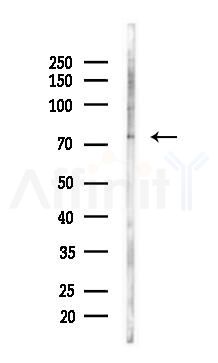BTK Antibody - Western blot analysis of lysates from COLO205 cells(heat-shock,45min treatment), using BTK Antibody at 1/1000 dilution.