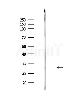 HLA-DRA Antibody - Western blot analysis of lysates from Hela cells(heat-shock,45min treatment), using HLA-DRA Antibody at 1/1000 dilution.