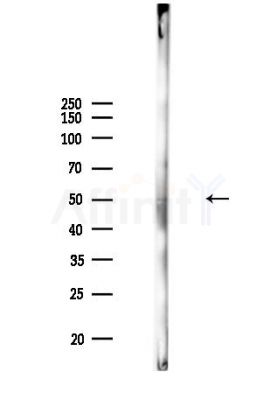 Renin Antibody - Western blot analysis of lysates from Mouse lung, using Renin Antibody at 1/1000 dilution.