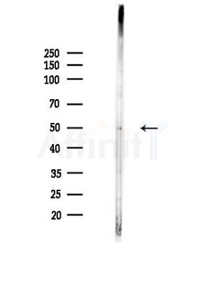 Renin Antibody - Western blot analysis of lysates from MDA-MB-231 cells(heat-shock,45min treatment), using Renin Antibody at 1/1000 dilution.