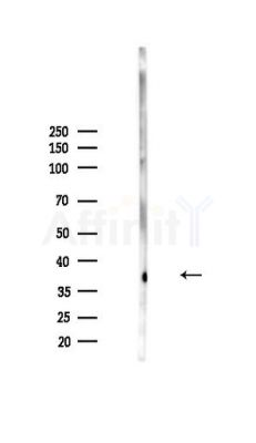 ABO Antibody - Western blot analysis of lysates from HepG2 cells(heat-shock,45min treatment), using ABO Antibody at 1/1000 dilution.