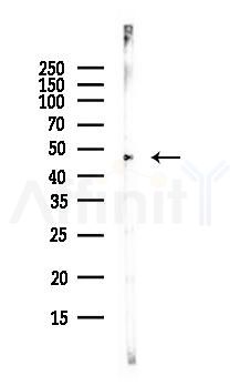 ETS1 Antibody - Western blot analysis of lysates from PC12 cells(LPS, 4h treatment), using ETS1 Antibody at 1/1000 dilution.