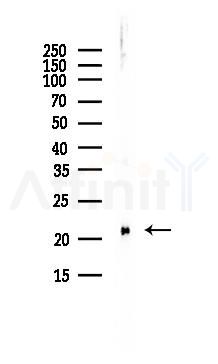 RBP4 Antibody - Western blot analysis of lysates from PC12 cells(LPS, 4h treatment), using RBP4 Antibody at 1/1000 dilution.