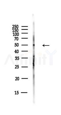 MMP13 Antibody - Western blot analysis of lysates from Hela cells(starvation,24h treatment), using MMP13 Antibody at 1/1000 dilution.