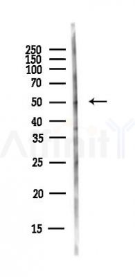 MMP13 Antibody - Western blot analysis of lysates from EC304 cells(heat-shock,45min treatment), using MMP13 Antibody at 1/1000 dilution.