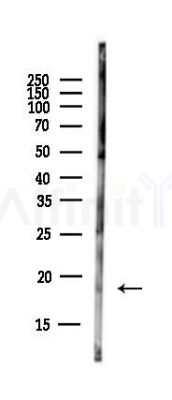 NPPA Antibody - Western blot analysis of lysates from EC304 cells(heat-shock,45min treatment), using NPPA Antibody at 1/1000 dilution.