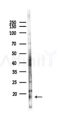 FABP2 Antibody - Western blot analysis of lysates from 293 cells(UV,30min treatment), using FABP2 Antibody at 1/1000 dilution.