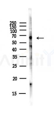 NOX2 Antibody - Western blot analysis of lysates from Hela cells(starvation,24h treatment), using NOX2 Antibody at 1/1000 dilution.