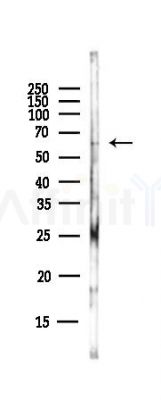NOX2 Antibody - Western blot analysis of lysates from EC304 cells(heat-shock,45min treatment), using NOX2 Antibody at 1/1000 dilution.