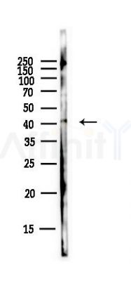 CD46 Antibody - Western blot analysis of lysates from Hela cells(starvation,24h treatment), using CD46 Antibody at 1/1000 dilution.