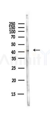 CD46 Antibody - Western blot analysis of lysates from EC304 cells(heat-shock,45min treatment), using CD46 Antibody at 1/1000 dilution.