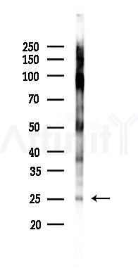 PTHLH Antibody - Western blot analysis of lysates from Rat testis, using PTHLH Antibody at 1/1000 dilution.
