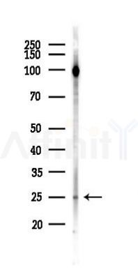 PTHLH Antibody - Western blot analysis of lysates from 293 cells(UV,30min treatment), using PTHLH Antibody at 1/1000 dilution.
