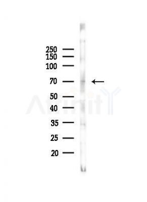 UGT1A9 Antibody - Western blot analysis of lysates from COLO205 cells(heat-shock, 45min treatment), using UGT1A9 Antibody at 1/1000 dilution.