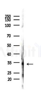 CD38 Antibody - Western blot analysis of lysates from PC12 cells, using CD38 Antibody at 1/1000 dilution.