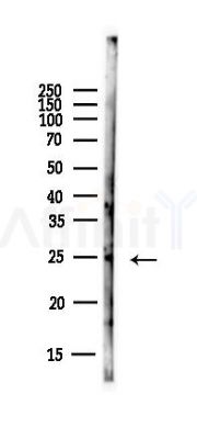 MAD2L1 Antibody - Western blot analysis of lysates from EC304 cells(heat-shock,45min treatment), using MAD2L1 Antibody at 1/1000 dilution.