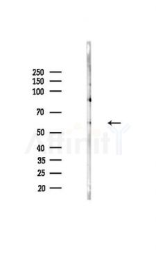 CD66/CEACAM1 Antibody - Western blot analysis of lysates from Hela cells(heat-shock,45min treatment), using CD66/CEACAM1 Antibody at 1/1000 dilution.