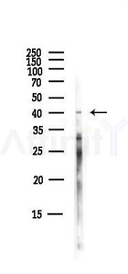 Annexin V Antibody - Western blot analysis of lysates from Hela cells(starvation,24h treatment), using Annexin V Antibody at 1/1000 dilution.