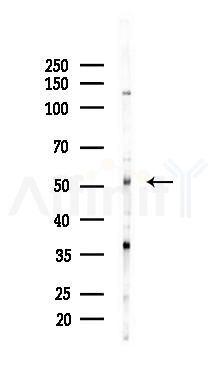 GABA A Receptor gamma 2 Antibody - Western blot analysis of lysates from COLO205 cells(heat-shock,45min treatment), using GABA A Receptor gamma 2 Antibody at 1/1000 dilution.