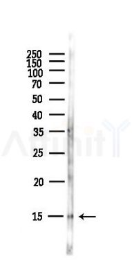 FKBP1A Antibody - Western blot analysis of lysates from Hela cells(starvation,24h treatment), using FKBP1A Antibody at 1/1000 dilution.