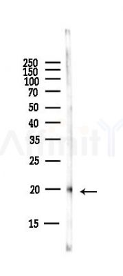 Ferritin Light Chain Antibody - Western blot analysis of lysates from Hela cells(starvation,24h treatment), using Ferritin Light Chain Antibody at 1/1000 dilution.