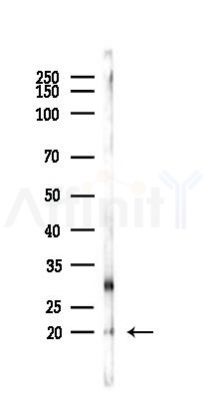 Ferritin Light Chain Antibody - Western blot analysis of lysates from PC12 cells, using Ferritin Light Chain Antibody at 1/1000 dilution.