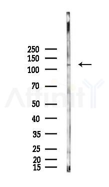 BUB1B Antibody - Western blot analysis of lysates from Hela cells(LPS, 4h treatment), using BUB1B Antibody at 1/1000 dilution.