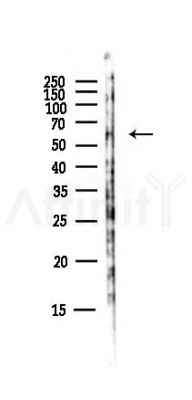 GGT1 Antibody - Western blot analysis of lysates from Hela cells(starvation,24h treatment), using GGT1 Antibody at 1/1000 dilution.