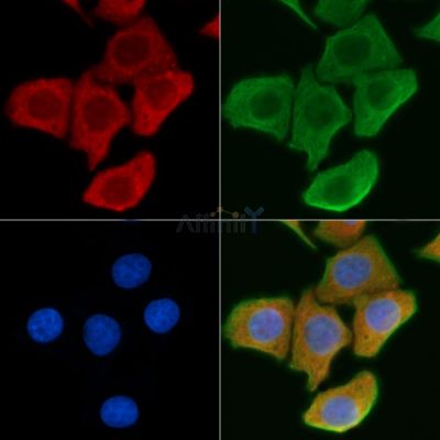 CTSK Antibody - DF6614 staining Hela cells by IF/ICC.