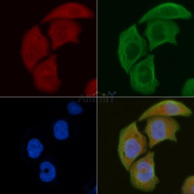 DCTN1 Antibody - DF6615 staining Hela cells by IF/ICC.