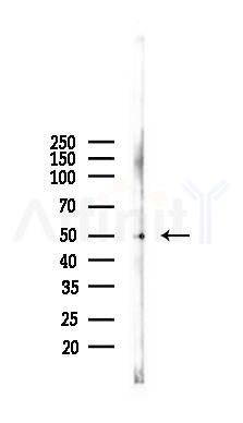 ALDH1A1 Antibody - Western blot analysis of lysates from Mouse testis, using ALDH1A1 Antibody at 1/1000 dilution.