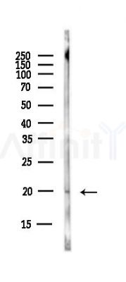 VIP Antibody - Western blot analysis of lysates from EC304 cells(heat-shock,45min treatment), using VIP Antibody at 1/1000 dilution.