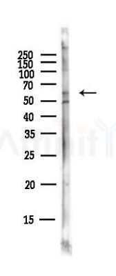 FANCC Antibody - Western blot analysis of lysates from Hela cells(starvation,24h treatment), using FANCC Antibody at 1/1000 dilution.