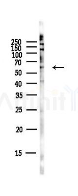 BMPR1A Antibody - Western blot analysis of lysates from Hela cells(starvation,24h treatment), using BMPR1A Antibody at 1/1000 dilution.