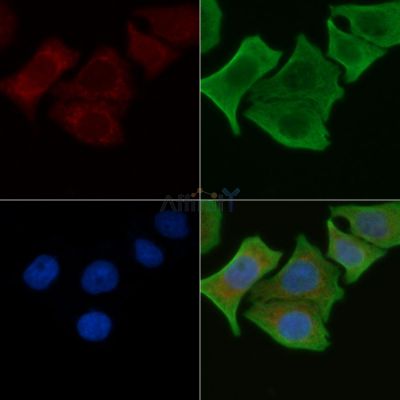 IL-10R alpha Antibody - DF6643 staining Hela cells by IF/ICC.