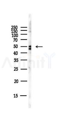 FCER2 Antibody - Western blot analysis of lysates from Hela cells(starvation,24h treatment), using FCER2 Antibody at 1/1000 dilution.