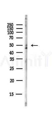 FCER2 Antibody - Western blot analysis of lysates from EC304 cells(heat-shock,45min treatment), using FCER2 Antibody at 1/1000 dilution.