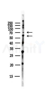 IKZF1 Antibody - Western blot analysis of lysates from Hela cells(starvation,24h treatment), using IKZF1 Antibody at 1/1000 dilution.