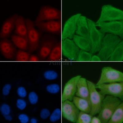 DKC1 Antibody - DF6666 staining Hela cells by IF/ICC.
