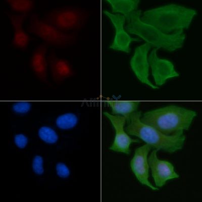 GLB1 Antibody - DF6667 staining Hela cells by IF/ICC.