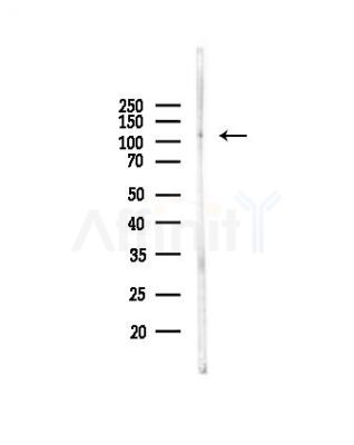 DNA Ligase III Antibody - Western blot analysis of lysates from PC12 cells(UV, 30min treatment), using DNA Ligase III Antibody at 1/1000 dilution.