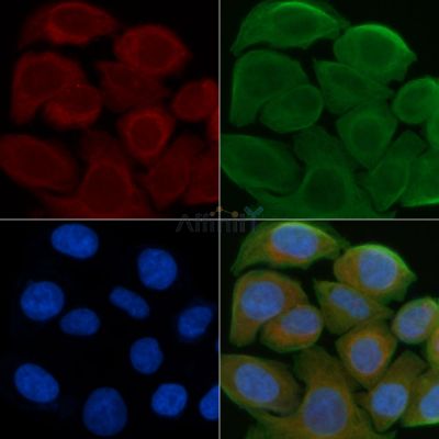 PDHA1 Antibody - DF6680 staining Hela cells by IF/ICC.