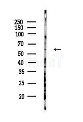 FMO3 Antibody - Western blot analysis of lysates from HepG2 cells(starvation,24h treatment), using FMO3 Antibody at 1/1000 dilution.