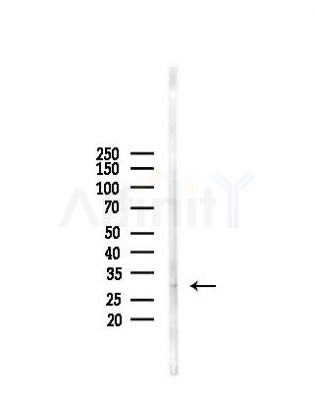 HOXA9 Antibody - Western blot analysis of lysates from Mouse liver, using HOXA9 Antibody at 1/1000 dilution.