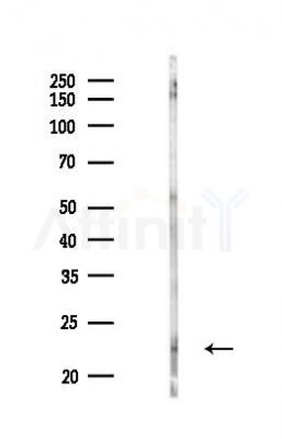 CNTF Antibody - Western blot analysis of lysates from Rat testis, using CNTF Antibody at 1/1000 dilution.