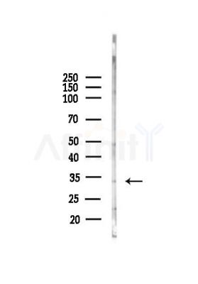 MNAT1 Antibody - Western blot analysis of lysates from COLO205 cells(heat-shock, 45min treatment), using MNAT1 Antibody at 1/1000 dilution.