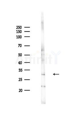 CD151 Antibody - Western blot analysis of lysates from HepG2 cells(LPS,4h treatment), using CD151 Antibody at 1/1000 dilution.