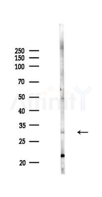 CD151 Antibody - Western blot analysis of lysates from A375 cells(heat-shock,45min treatment), using CD151 Antibody at 1/1000 dilution.